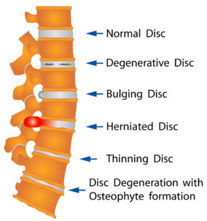 lumbar spine